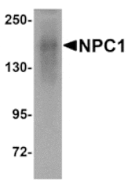 Western blot - NPC1 Antibody from Signalway Antibody (24900) - Antibodies.com
