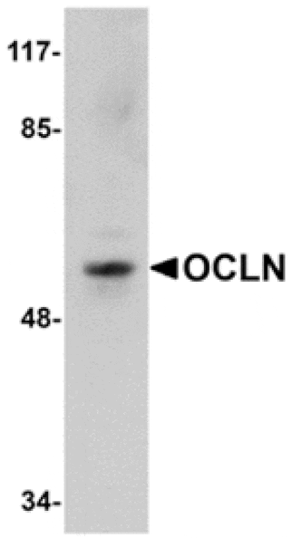 Western blot - OCLN Antibody from Signalway Antibody (24902) - Antibodies.com