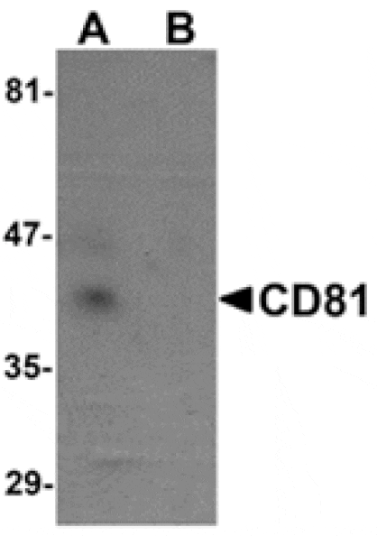 Western blot - CD81 Antibody from Signalway Antibody (24904) - Antibodies.com