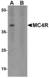 Western blot - MC4R Antibody from Signalway Antibody (24906) - Antibodies.com