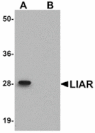 Western blot - LIAR Antibody from Signalway Antibody (24931) - Antibodies.com