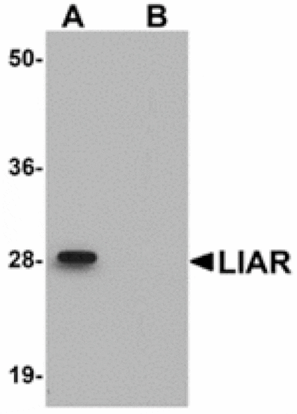 Western blot - LIAR Antibody from Signalway Antibody (24931) - Antibodies.com