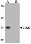 Western blot - LIAR Antibody from Signalway Antibody (24931) - Antibodies.com