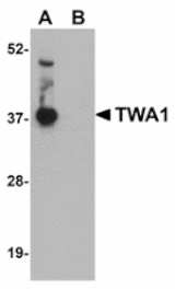 Western blot - TWA1 Antibody from Signalway Antibody (24949) - Antibodies.com