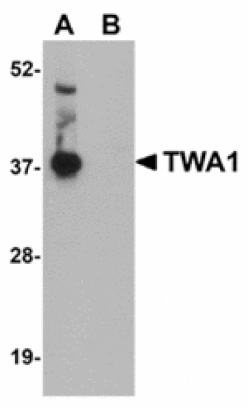 Western blot - TWA1 Antibody from Signalway Antibody (24949) - Antibodies.com