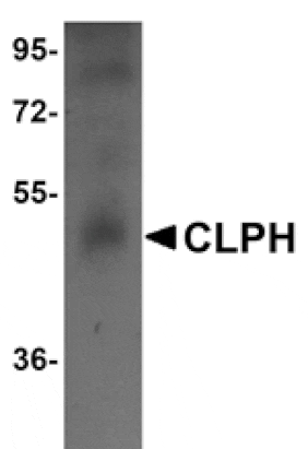 Western blot - CLPH Antibody from Signalway Antibody (25009) - Antibodies.com