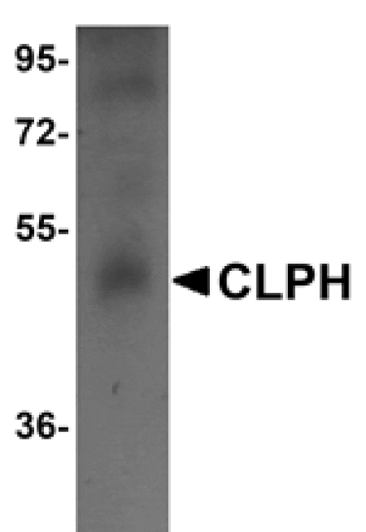 Western blot - CLPH Antibody from Signalway Antibody (25009) - Antibodies.com