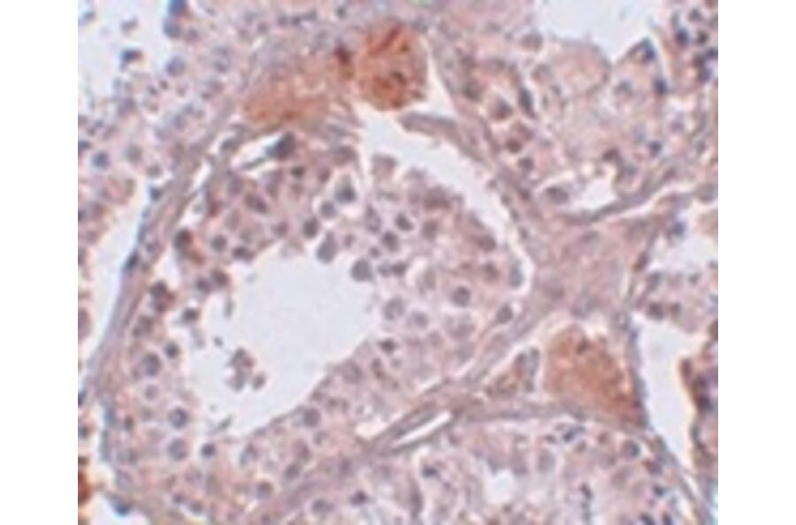 Immunohistochemistry - CLPH Antibody from Signalway Antibody (25009) - Antibodies.com
