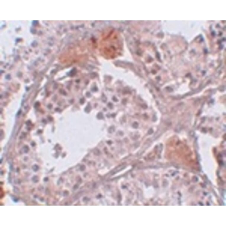 Immunohistochemistry - CLPH Antibody from Signalway Antibody (25009) - Antibodies.com