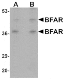 Western blot - BFAR Antibody from Signalway Antibody (25048) - Antibodies.com