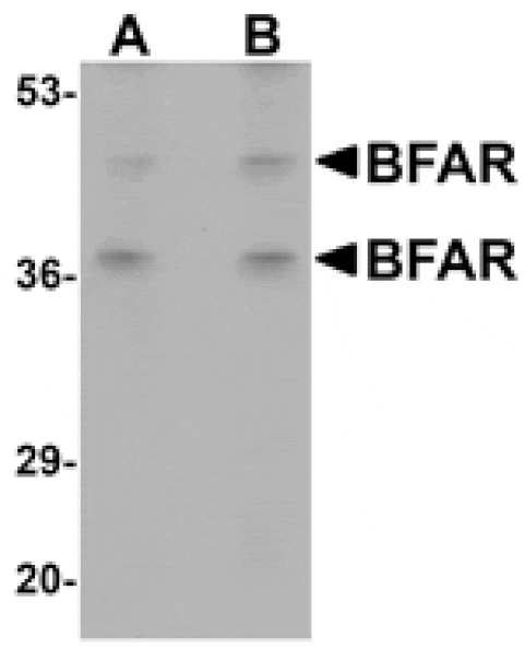 Western blot - BFAR Antibody from Signalway Antibody (25048) - Antibodies.com