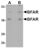 Western blot - BFAR Antibody from Signalway Antibody (25048) - Antibodies.com