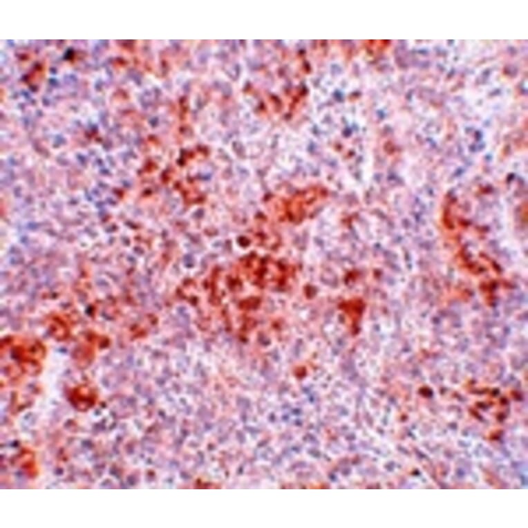 Immunohistochemistry - BFAR Antibody from Signalway Antibody (25048) - Antibodies.com