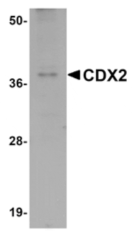 Western blot - CDX2 Antibody from Signalway Antibody (25050) - Antibodies.com