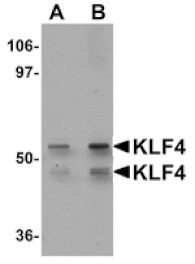 Western blot - KLF4 Antibody from Signalway Antibody (25054) - Antibodies.com