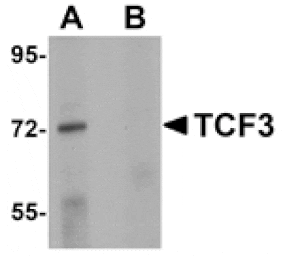 Western blot - TCF3 Antibody from Signalway Antibody (25057) - Antibodies.com