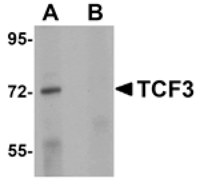 Western blot - TCF3 Antibody from Signalway Antibody (25057) - Antibodies.com