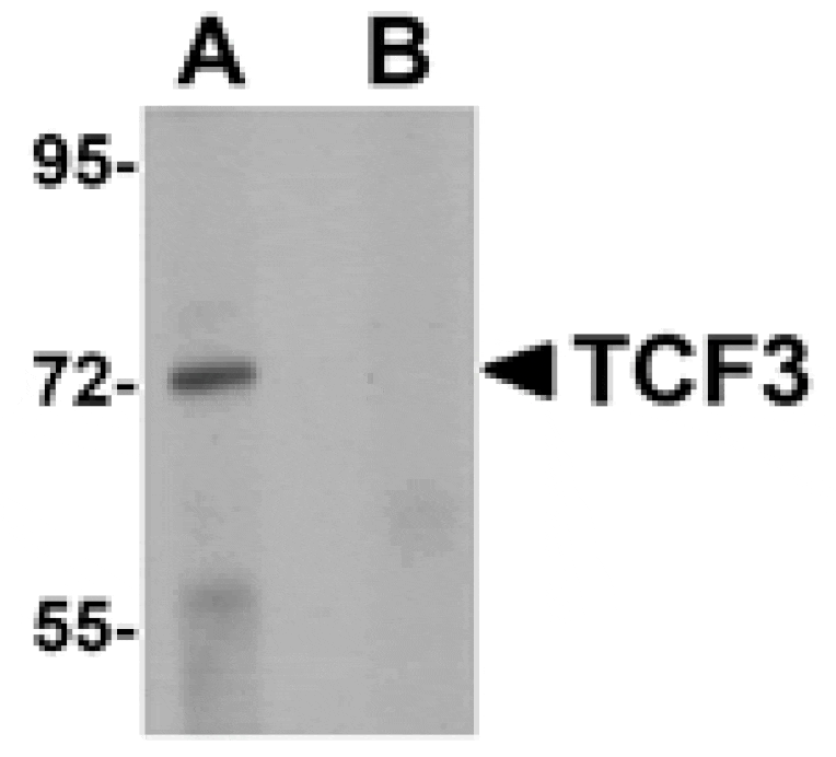 Western blot - TCF3 Antibody from Signalway Antibody (25057) - Antibodies.com
