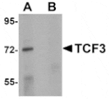 Western blot - TCF3 Antibody from Signalway Antibody (25057) - Antibodies.com