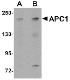 Western blot - APC1 Antibody from Signalway Antibody (25100) - Antibodies.com