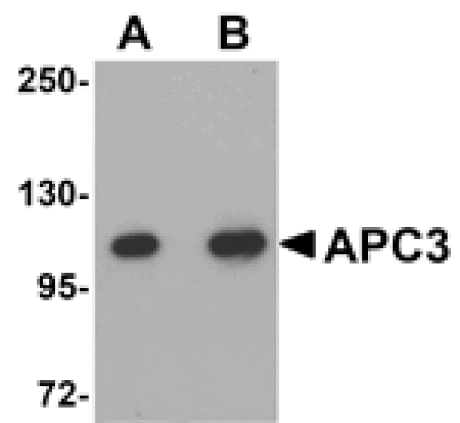 Western blot - APC3 Antibody from Signalway Antibody (25102) - Antibodies.com