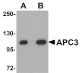 Western blot - APC3 Antibody from Signalway Antibody (25102) - Antibodies.com