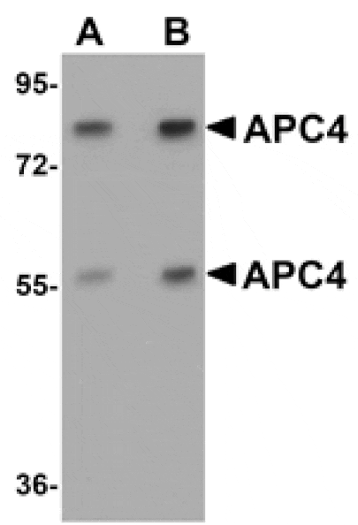 Western blot - APC4 Antibody from Signalway Antibody (25103) - Antibodies.com