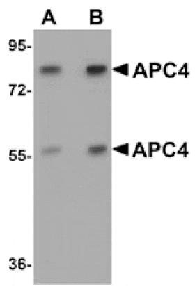 Western blot - APC4 Antibody from Signalway Antibody (25103) - Antibodies.com