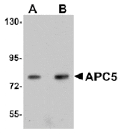 Western blot - APC5 Antibody from Signalway Antibody (25104) - Antibodies.com
