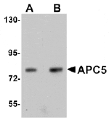 Western blot - APC5 Antibody from Signalway Antibody (25104) - Antibodies.com