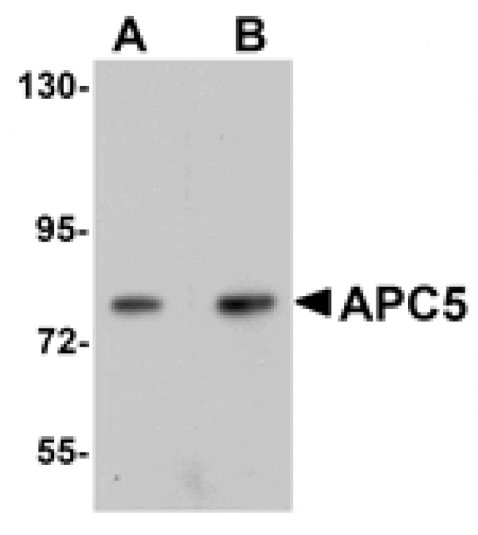 Western blot - APC5 Antibody from Signalway Antibody (25104) - Antibodies.com