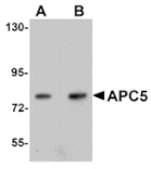 Western blot - APC5 Antibody from Signalway Antibody (25104) - Antibodies.com