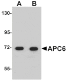 Western blot - APC6 Antibody from Signalway Antibody (25105) - Antibodies.com
