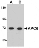 Western blot - APC6 Antibody from Signalway Antibody (25105) - Antibodies.com
