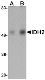 Western blot - IDH2 Antibody from Signalway Antibody (25142) - Antibodies.com