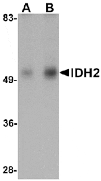 Western blot - IDH2 Antibody from Signalway Antibody (25142) - Antibodies.com