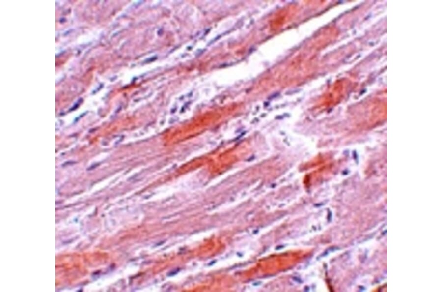 Immunohistochemistry - IDH2 Antibody from Signalway Antibody (25142) - Antibodies.com
