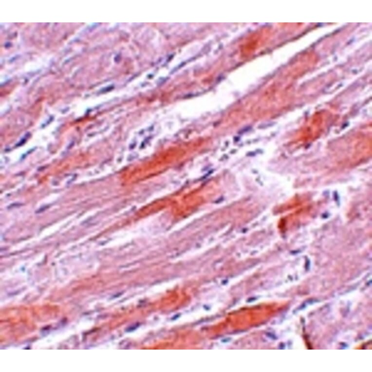 Immunohistochemistry - IDH2 Antibody from Signalway Antibody (25142) - Antibodies.com