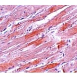 Immunohistochemistry - IDH2 Antibody from Signalway Antibody (25142) - Antibodies.com