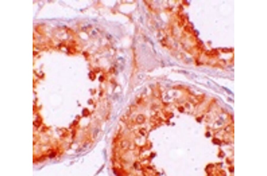 Immunohistochemistry - YBX2 Antibody from Signalway Antibody (25171) - Antibodies.com