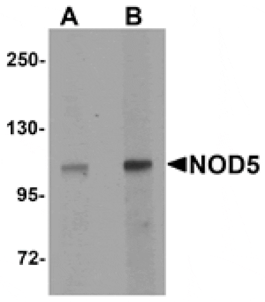 Western blot - NOD5 Antibody from Signalway Antibody (25177) - Antibodies.com