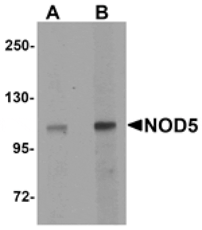 Western blot - NOD5 Antibody from Signalway Antibody (25177) - Antibodies.com