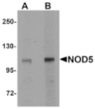 Western blot - NOD5 Antibody from Signalway Antibody (25177) - Antibodies.com