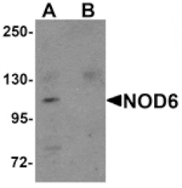 Western blot - NOD6 Antibody from Signalway Antibody (25178) - Antibodies.com