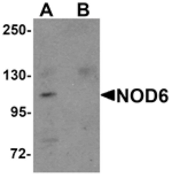 Western blot - NOD6 Antibody from Signalway Antibody (25178) - Antibodies.com