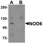 Western blot - NOD6 Antibody from Signalway Antibody (25178) - Antibodies.com