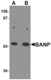 Western blot - BANP Antibody from Signalway Antibody (25189) - Antibodies.com