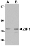 Western blot - ZIP1 Antibody from Signalway Antibody (25224) - Antibodies.com