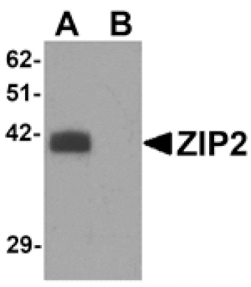 Western blot - ZIP2 Antibody from Signalway Antibody (25225) - Antibodies.com