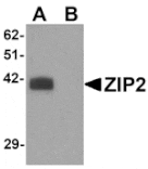 Western blot - ZIP2 Antibody from Signalway Antibody (25225) - Antibodies.com